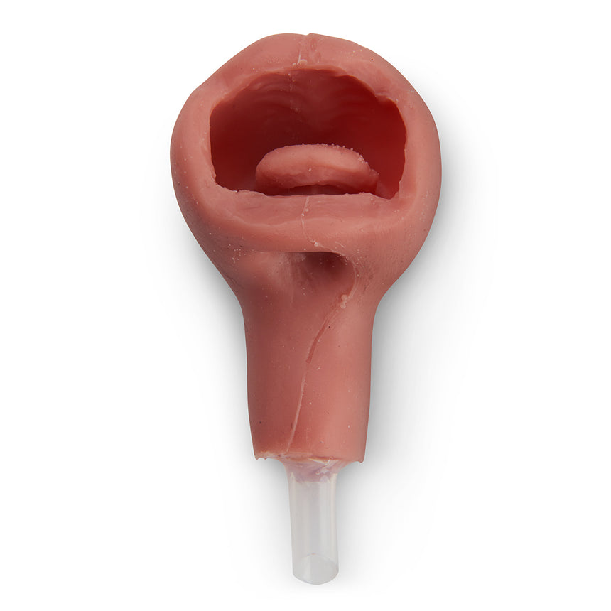 Replacement Airway
