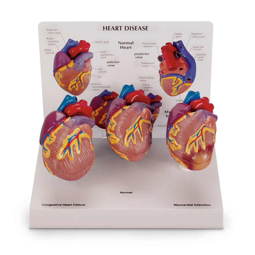 3-Piece Mini Heart Set Models [SKU: SB44893]