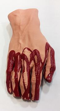 Hand With Severed Fingers