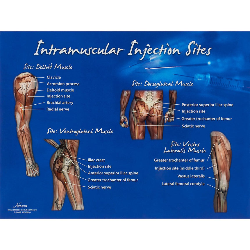 Intramuscular Injection Sites Chart