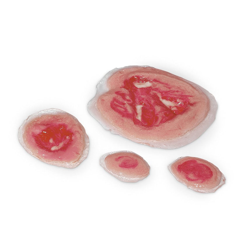 Life/form® Wound - Pressure Ulcers