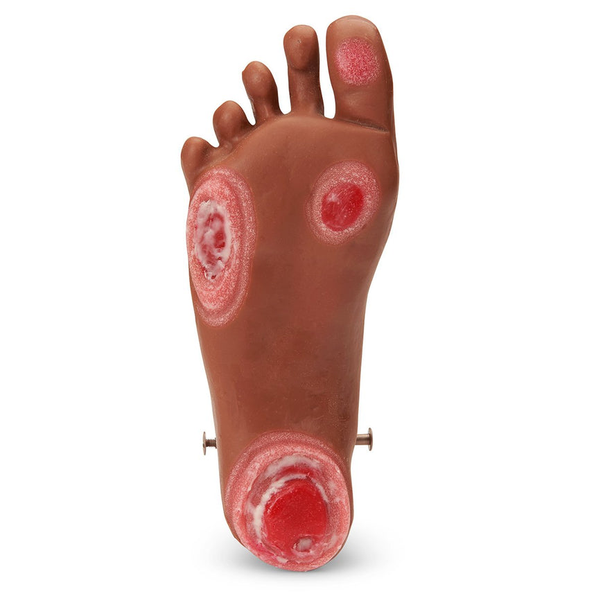 Life/form®  GERi™ / KERi™  Optional Pressure Injury Foot - Medium  [SKU: LF04128]