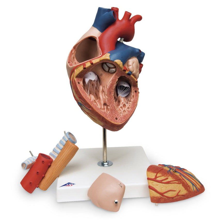 Heart with Esophagus and Trachea Model [SKU: SB41433]