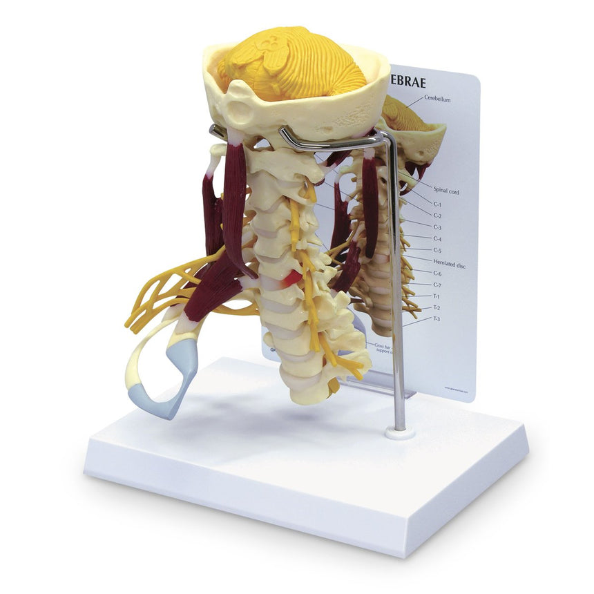 Life-Size Cervical Model with Muscles and Nerves