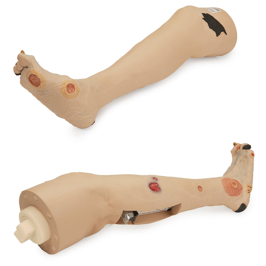 Annie Arterial Insufficiency Leg™ [SKU: SB50122]